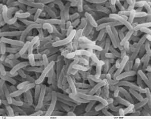 Electron microscope image of Vibrio Cholera bacteria 